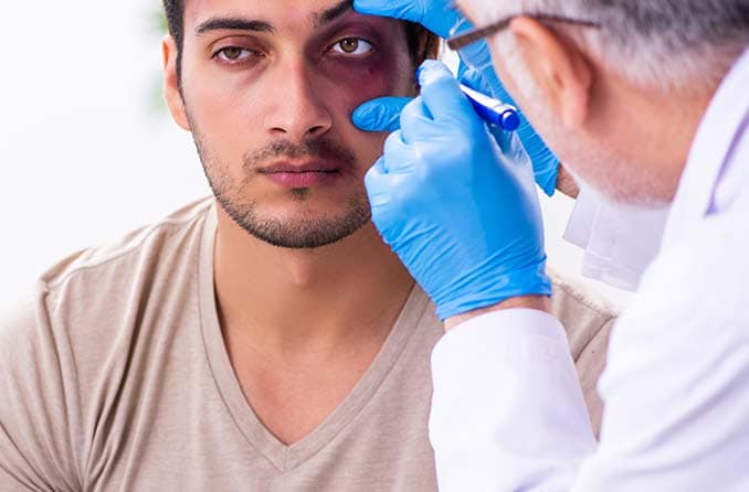 Mata lebam: Bagaimana cara meredakan pembengkakan