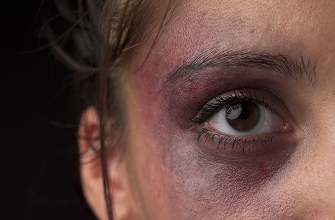 Cedera mata: Pengobatan trauma okular 