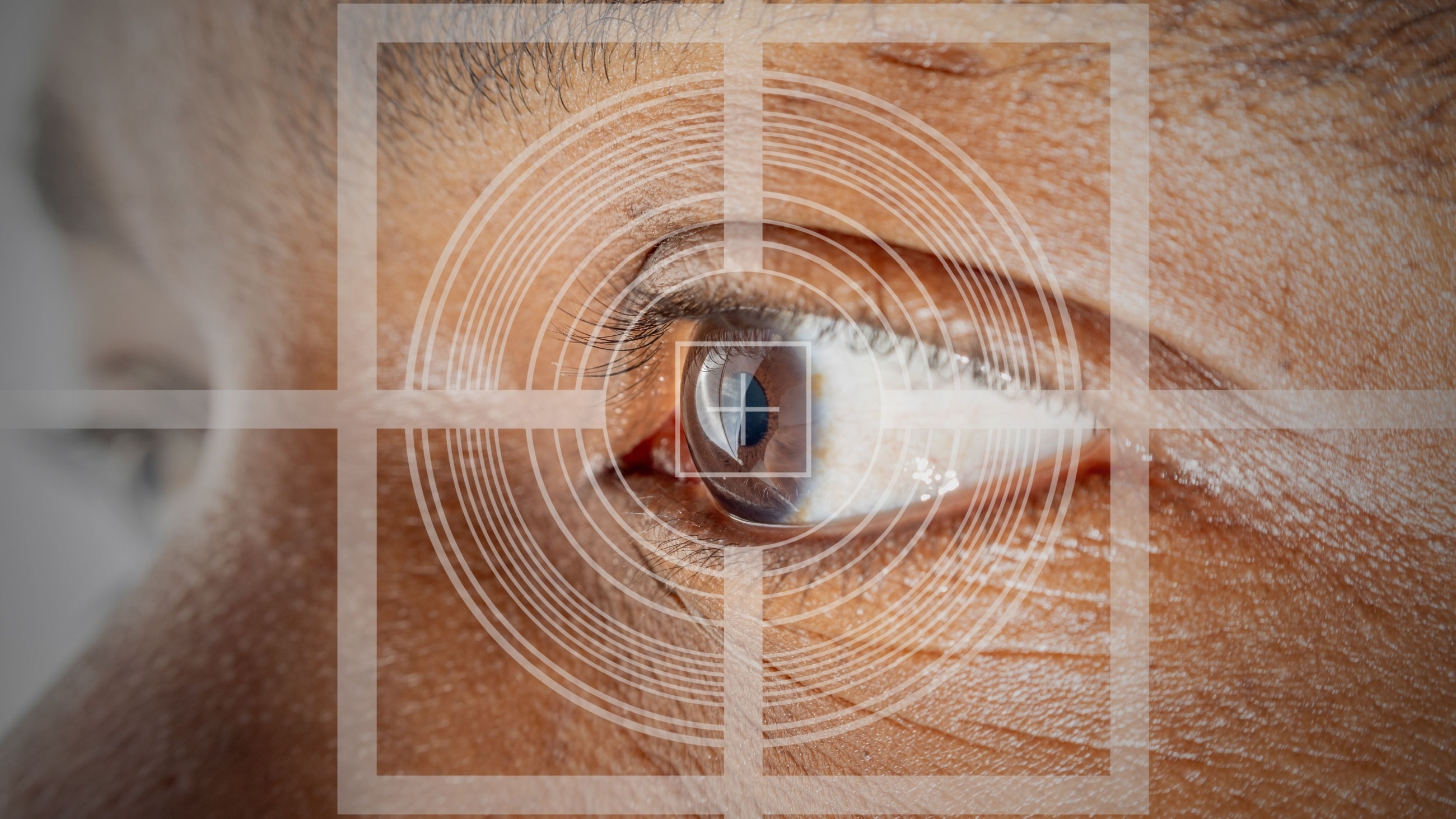 Lasik Eye Surgery Lasik Eye Surgery