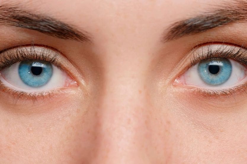 Anisometropia: Definition and treatments