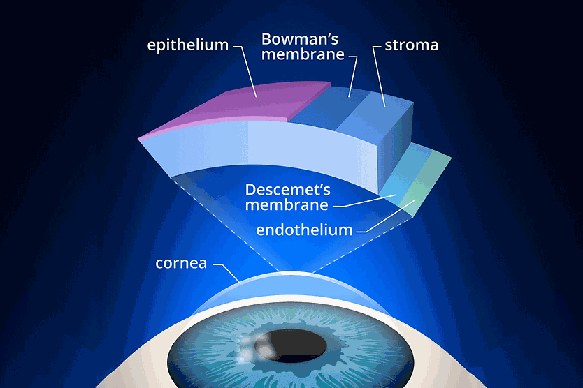 Descemetocele and corneal perforation from corneal ulcers layers of the cornea including the Descemet's membrane