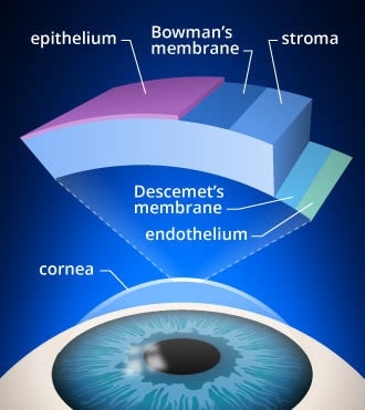 Corneal scarring: Causes, symptoms, treatment and healing time