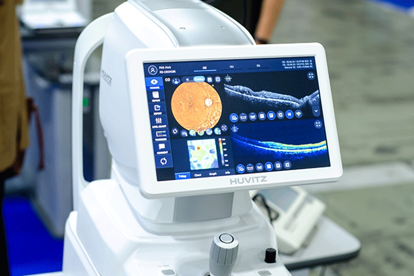 Epiretinal membrane (macular pucker) Optical coherence tomography angiography machine that detects epiretinal membrane or macular pucker