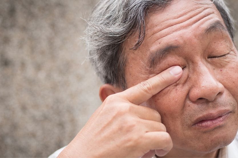 man rubbing infected eye with eye worms