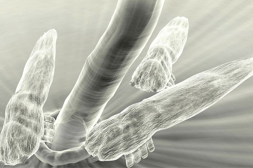 How do you get eyelash mites, and what are the symptoms and treatments? magnified view of eyelid mites around an eyelash follicle.