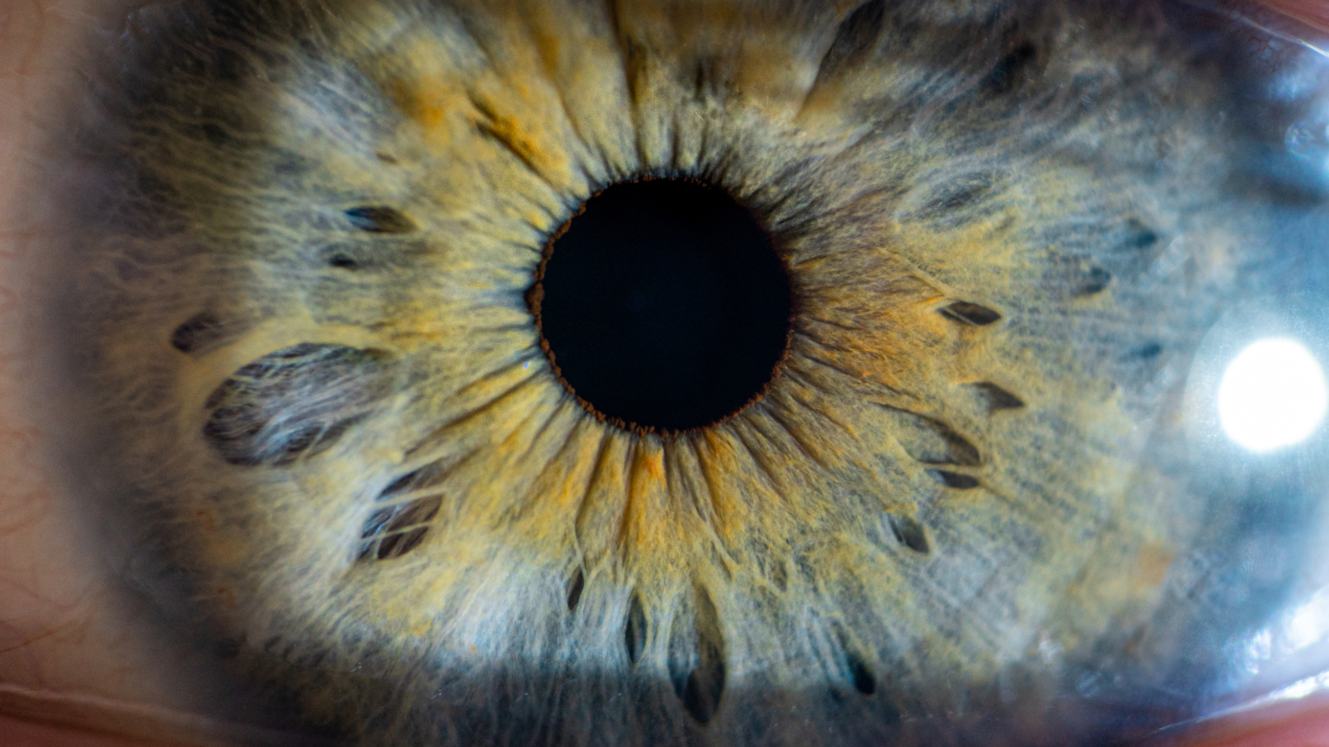 closeup of an eyeball with globe luxation