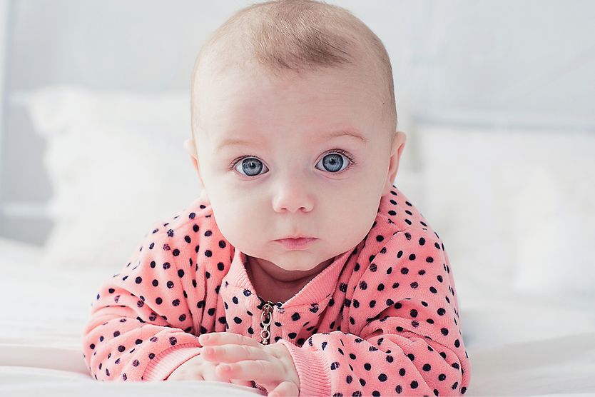 baby with small eye syndrome (microphthalmia)