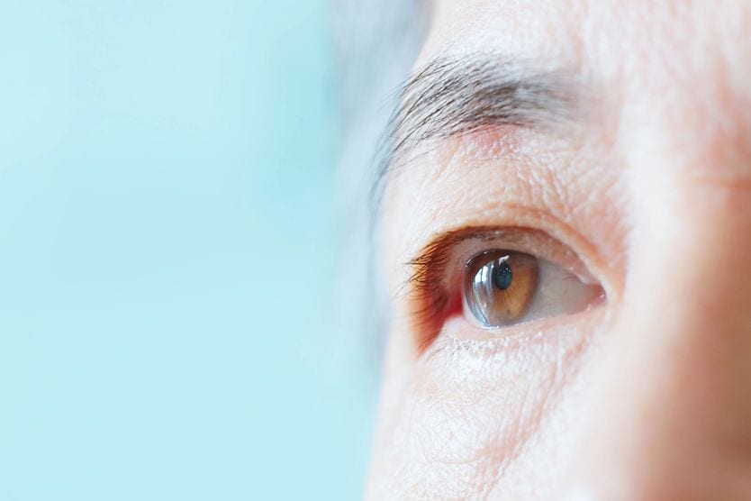 Up close image of woman with eye wrinkles