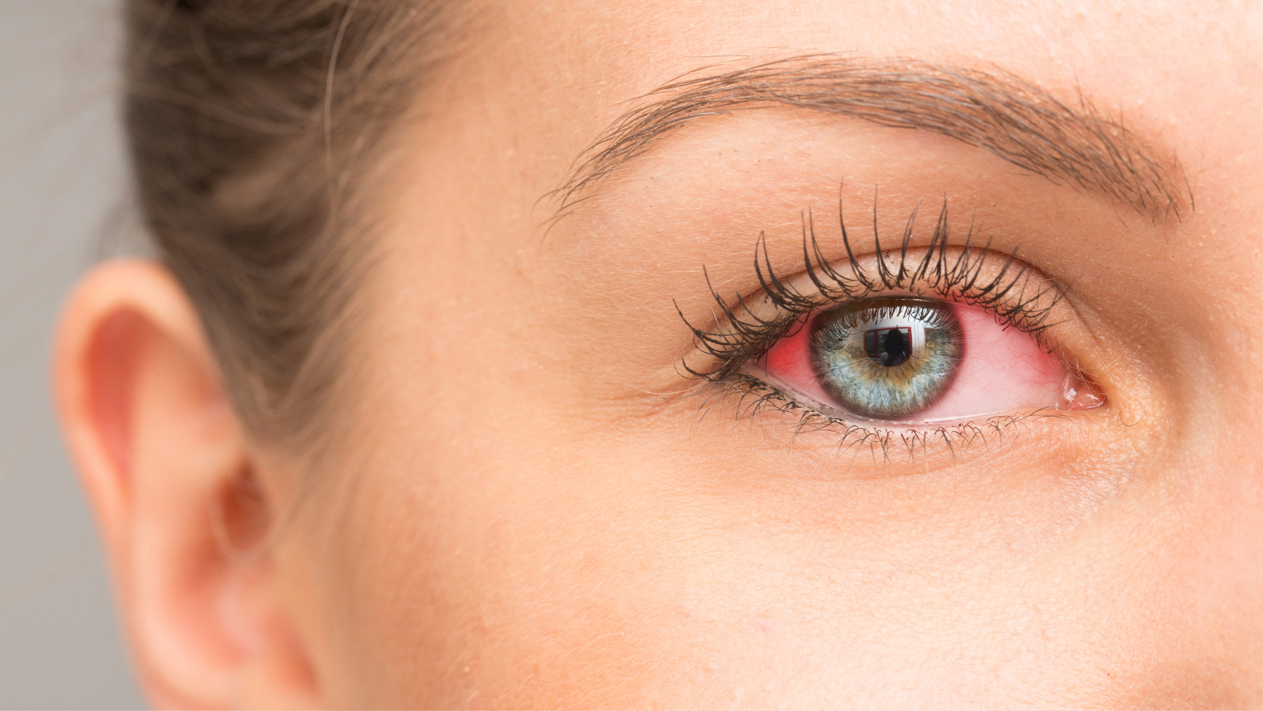 Dry eye treatment: How to soothe irritated eyes