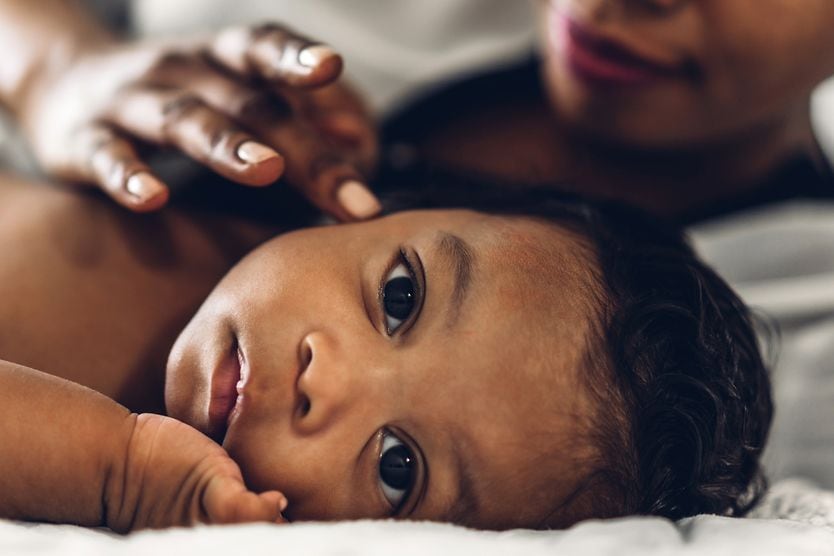 Congenital glaucoma: Causes, symptoms and treatment baby with congenital glaucoma