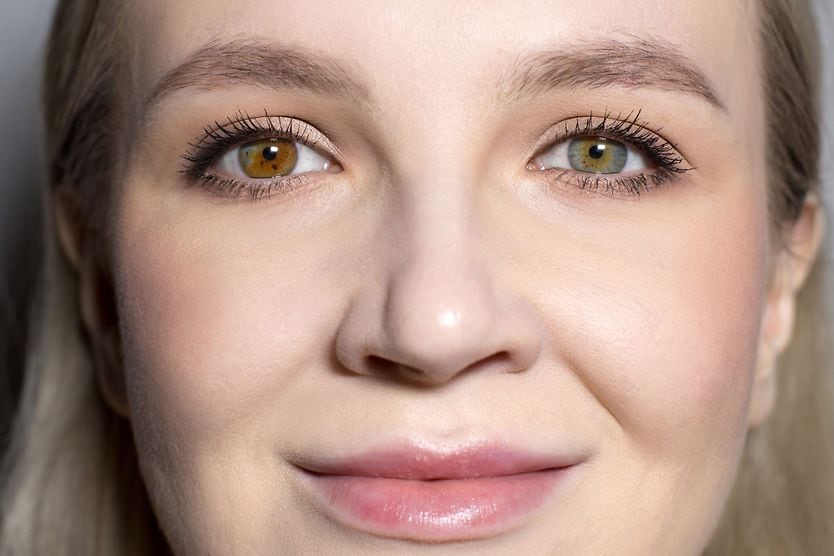 Celebrities with different-colored eyes (heterochromia) Kate Bosworth celebrity with heterochromia