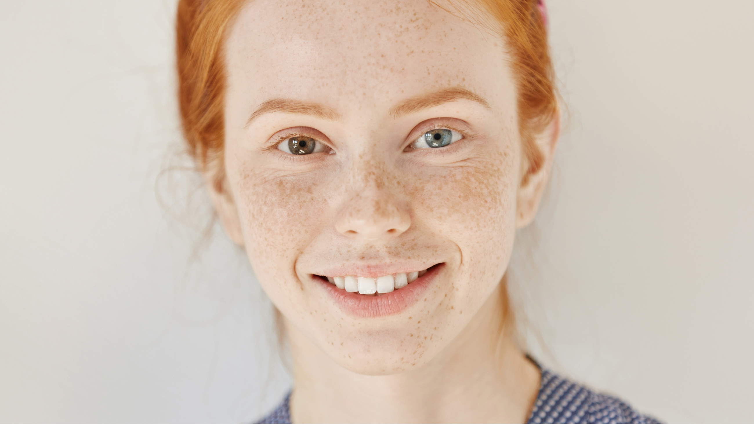 Girl with heterochromia