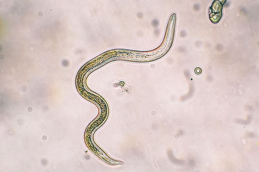 Toxocariasis Toxocariasis parasite