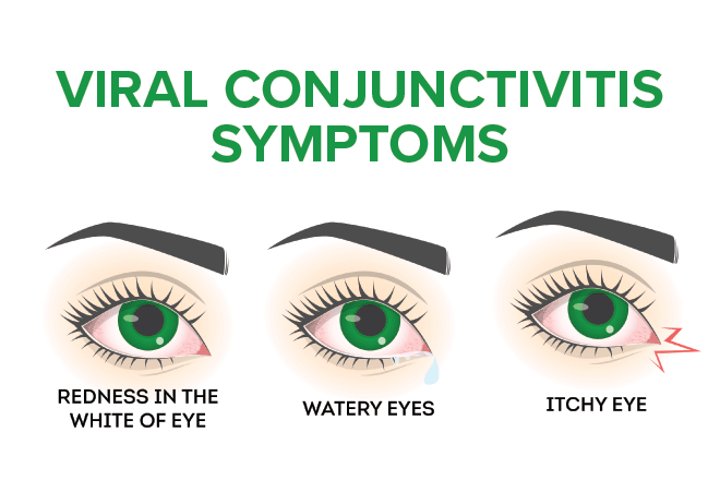 Symptoms of pink eye based on type of conjunctivitis Symptoms of pink eye based on type of conjunctivitis