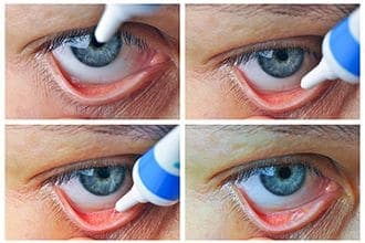 Stye Medicine: Prescription and OTC Eye Drops and Ointments