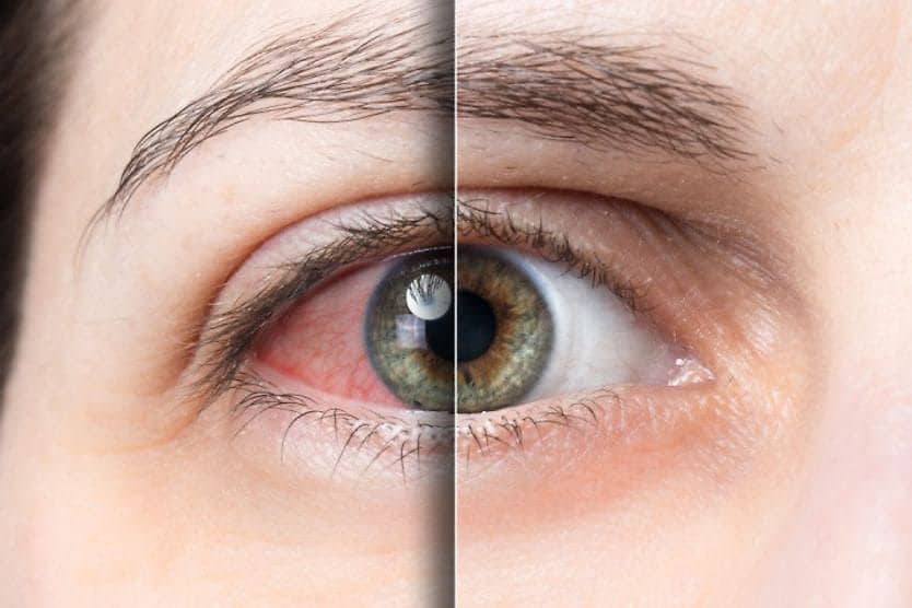 glp 1 eye twitch GLP-1s and Eye Health: What You Need to Know