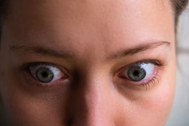 Graves’ disease and how it can affect the eyes Graves’ disease and how it can affect the eyes