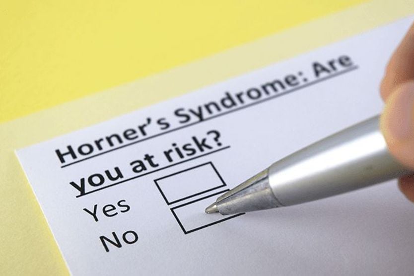 Horner’s syndrome risk assessment questionnaire for Horner's syndrome
