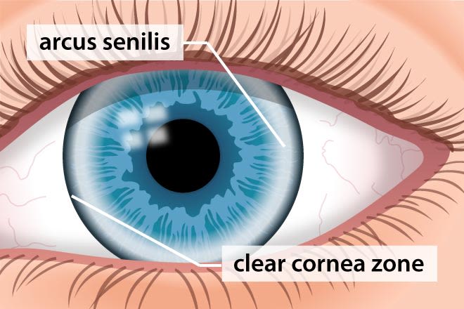 What your eye doctor can tell about your heart health What your eye doctor can tell about your heart health