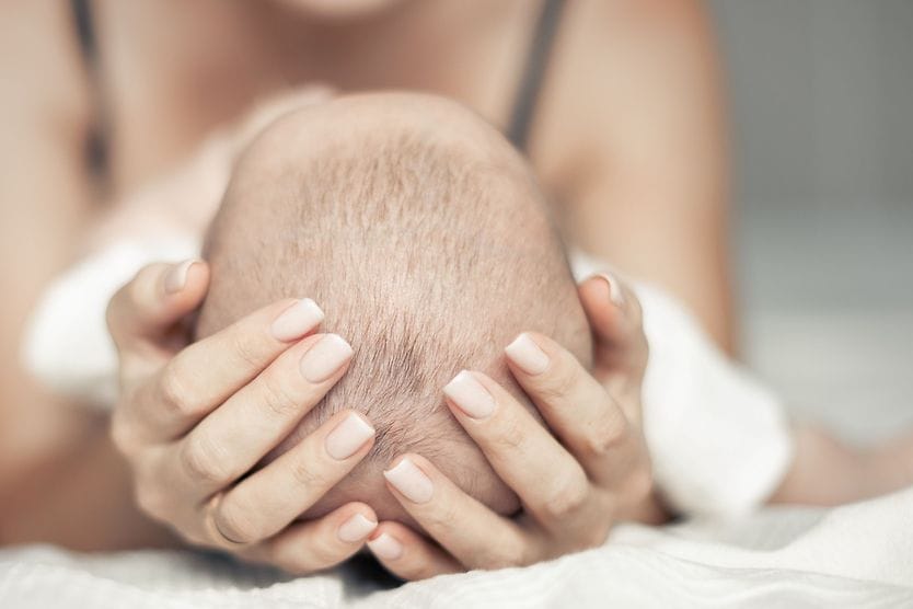 Setting sun eye phenomenon in infants