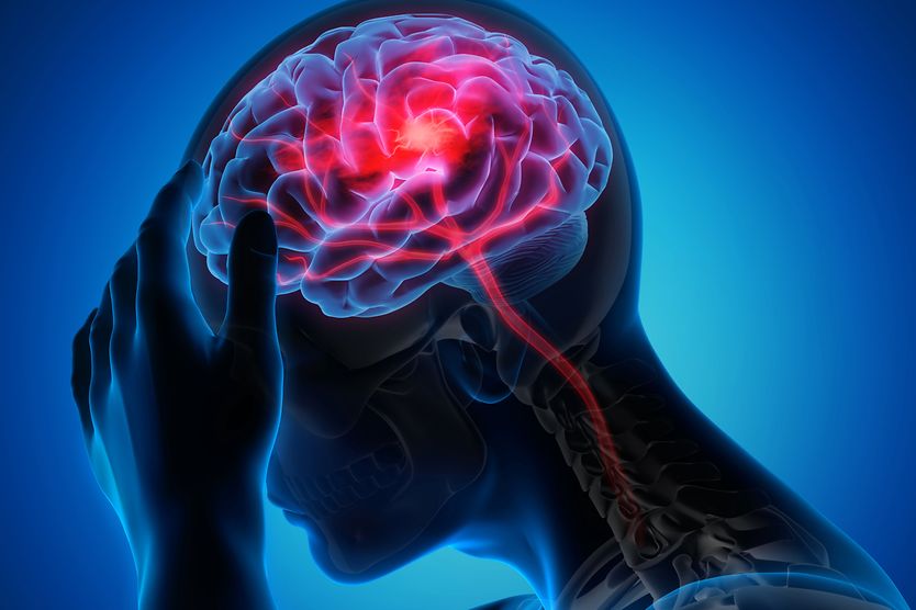 A guide to vision changes that can occur after a stroke person having a stroke 3D illustration