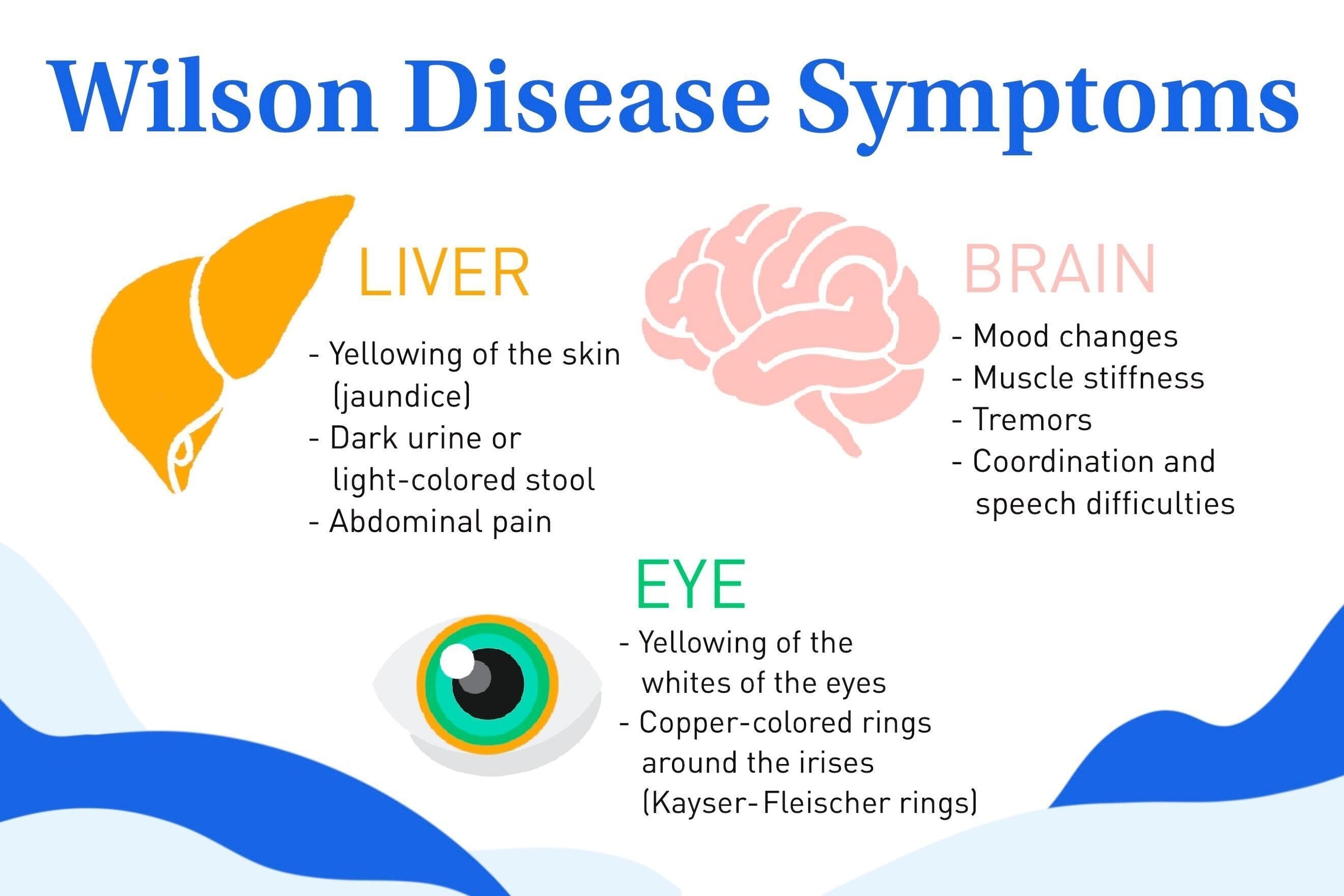 Visual snow syndrome: Causes, symptoms and treatment