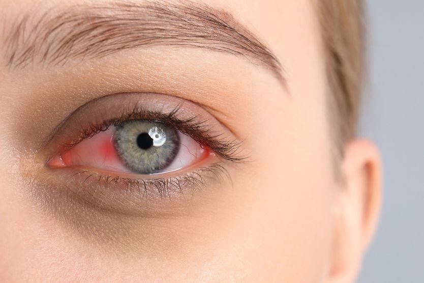 woman with pink eye