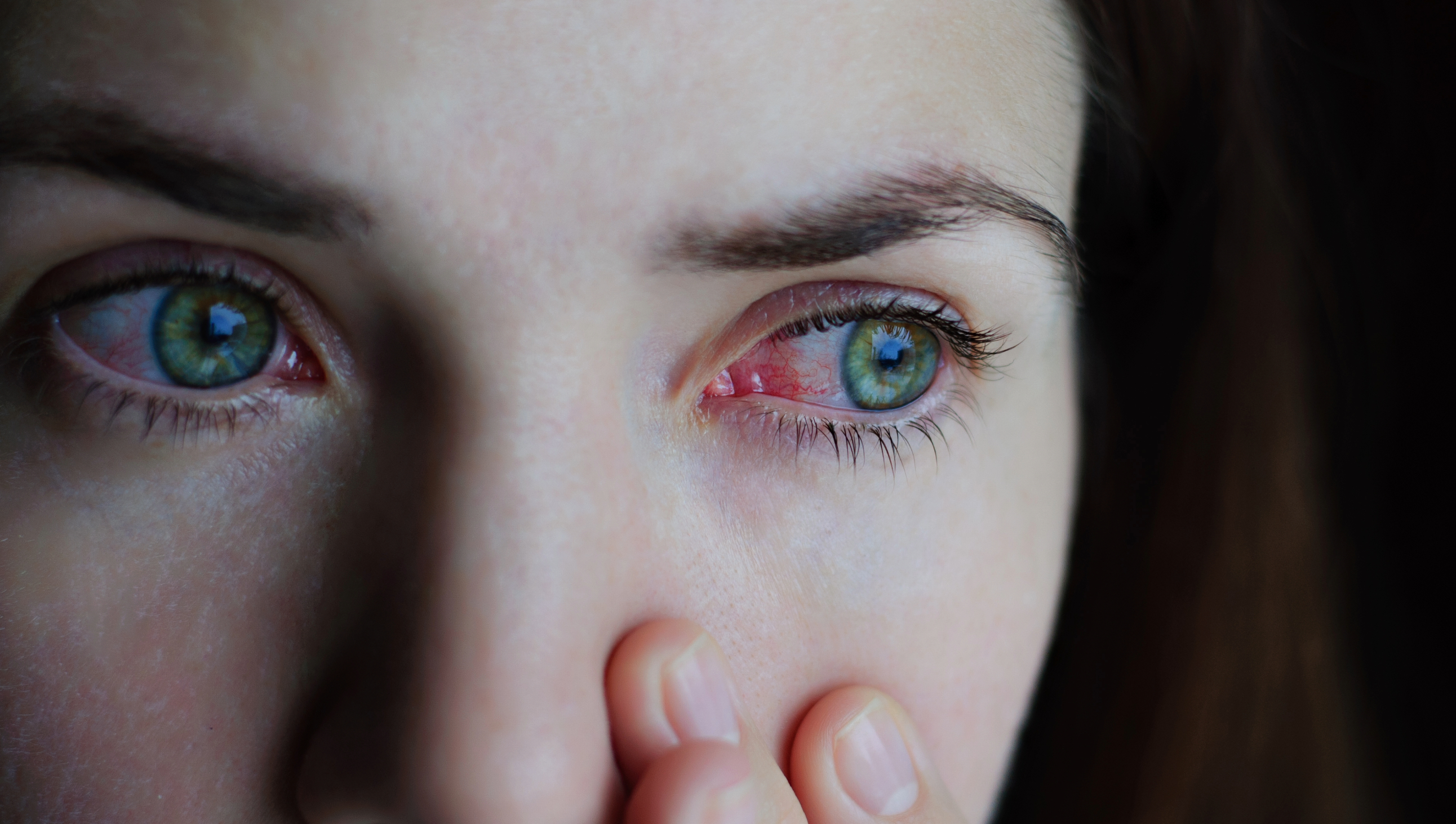 woman with red eyes and coronavirus