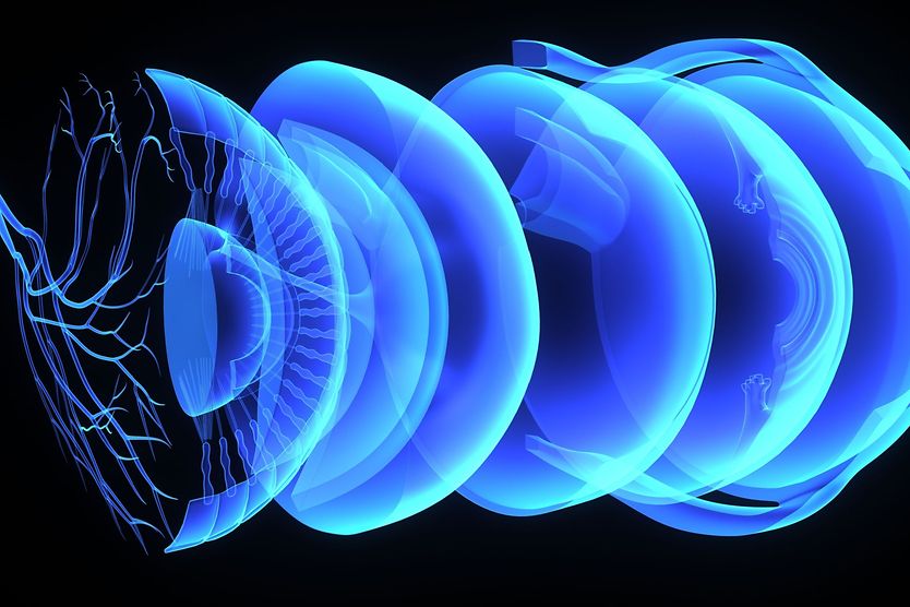 Retinal detachment illustration of a detached retina