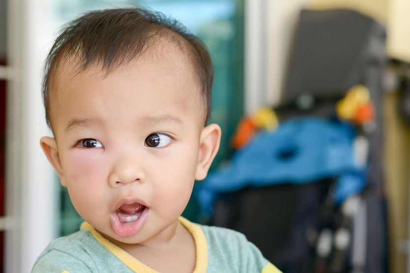Periorbital Edema young boy with periorbital edema on one eye