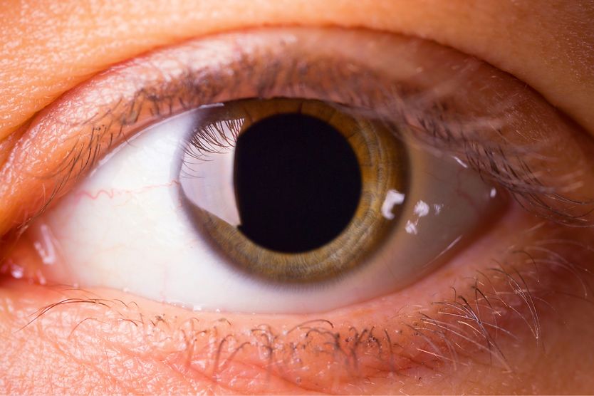 What is a blown pupil? closeup of a dilated pupil or blown pupil