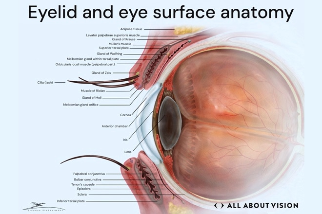 Eye redness (bloodshot eyes)