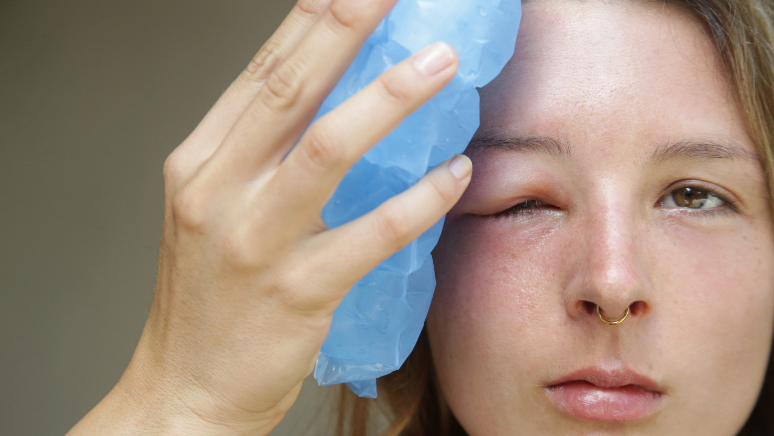 woman with a swollen eyelid