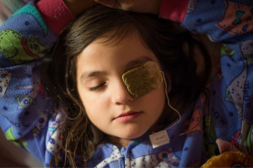 young girl with tea bag over swollen eyelid as a home remedy