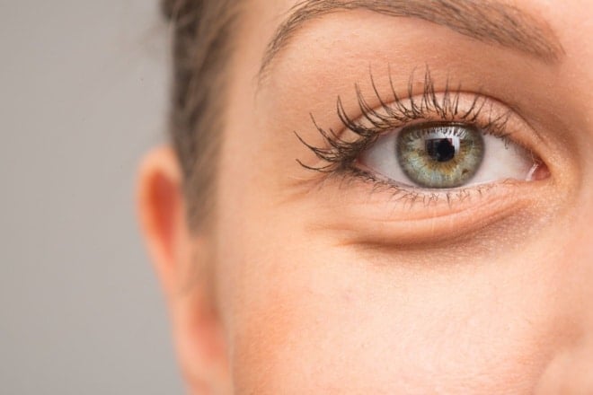 How to get rid of bags under your eyes