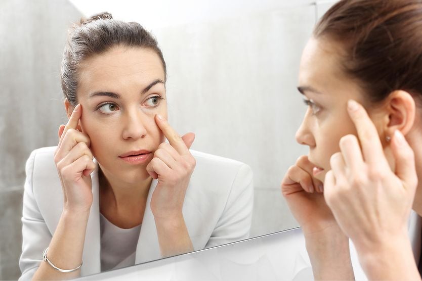 How to get rid of bags under your eyes Woman with bags under eyes