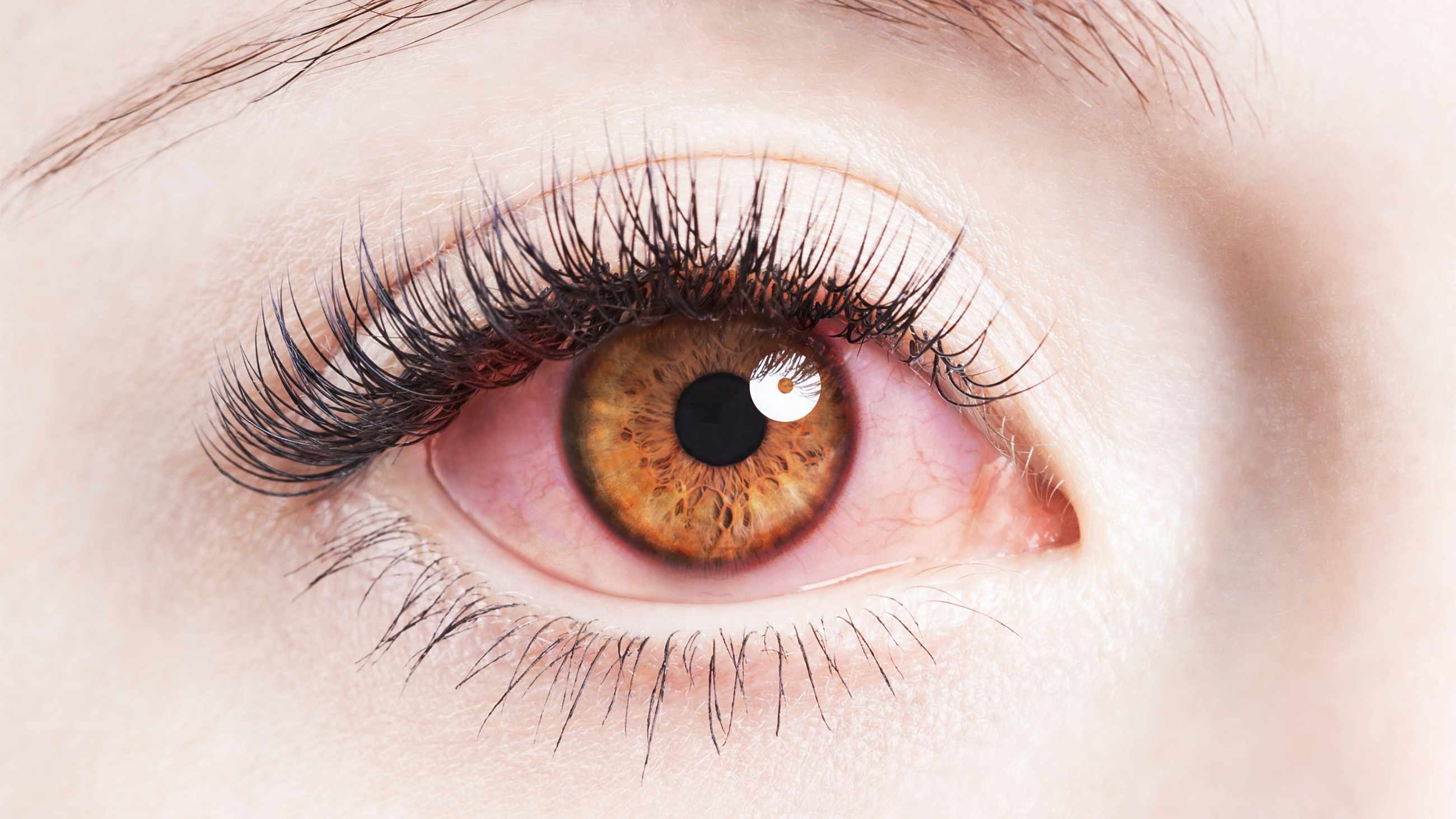 closeup of an infected eye from makeup