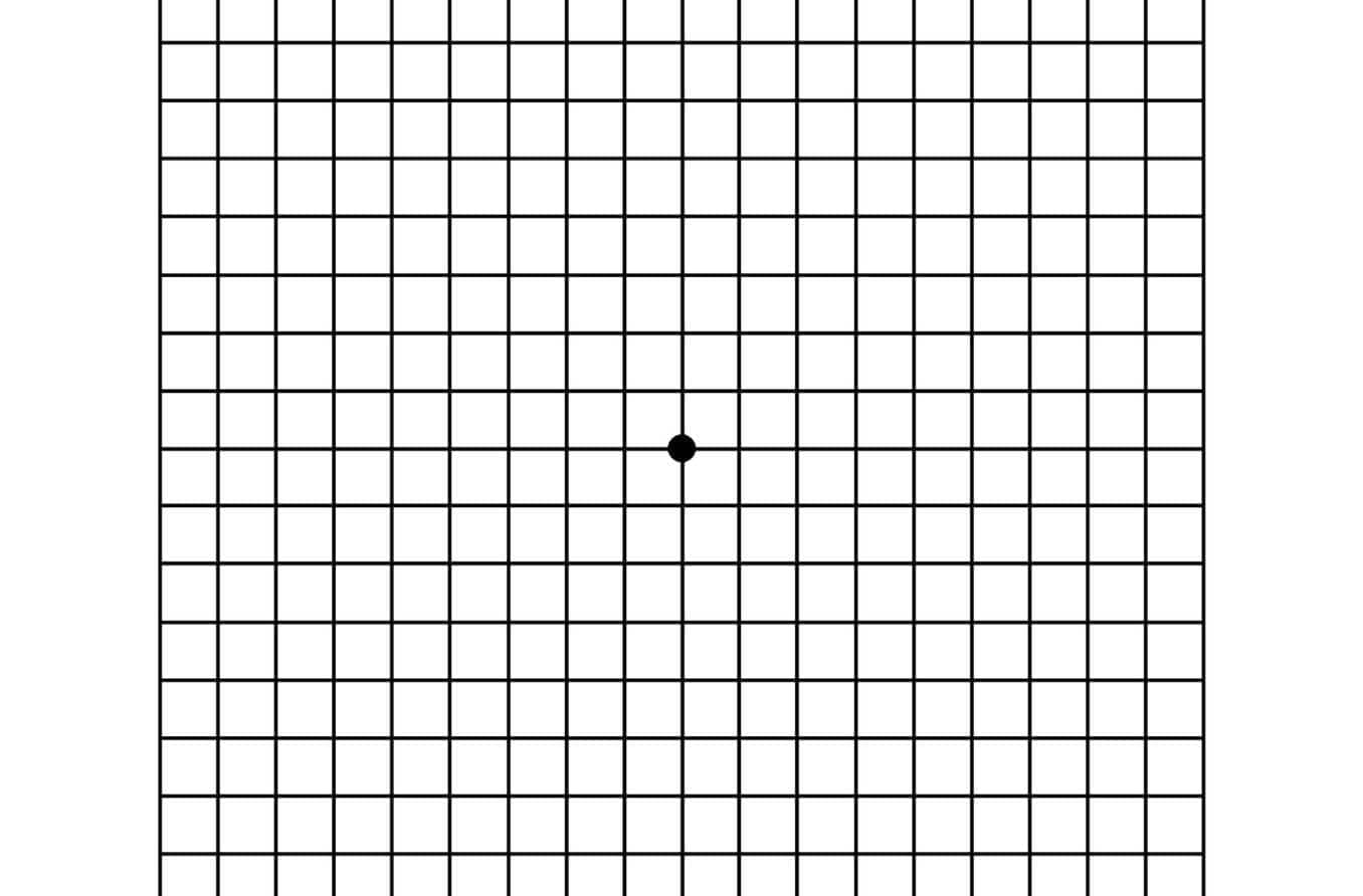Peripheral vision: Tests, issues and FAQs Amsler Grid pdf