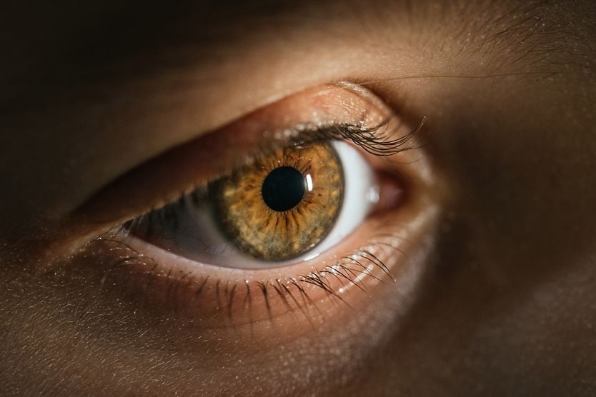 Hazel eyes: What determines hazel eye color? Hazel eye color