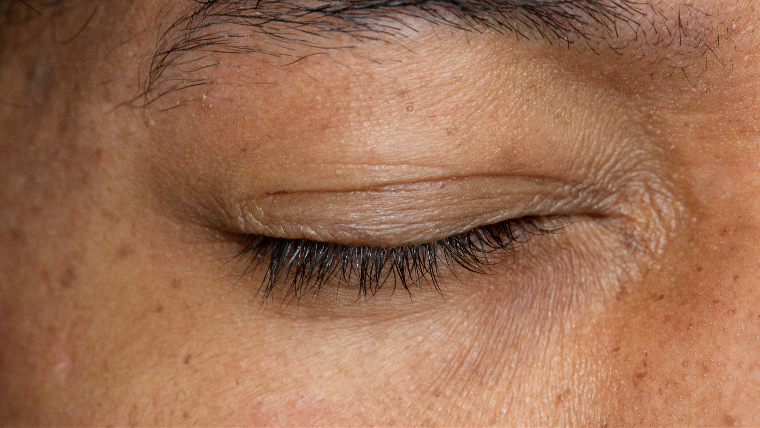 closeup of a man's eyelid