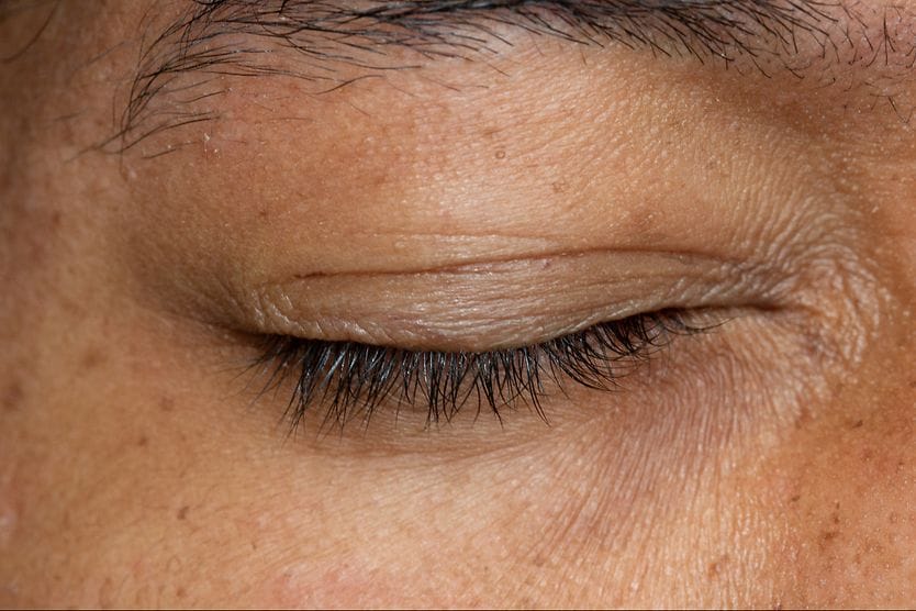 Eyelid: Parts of the eyelid and how they work closeup of a man's eyelid