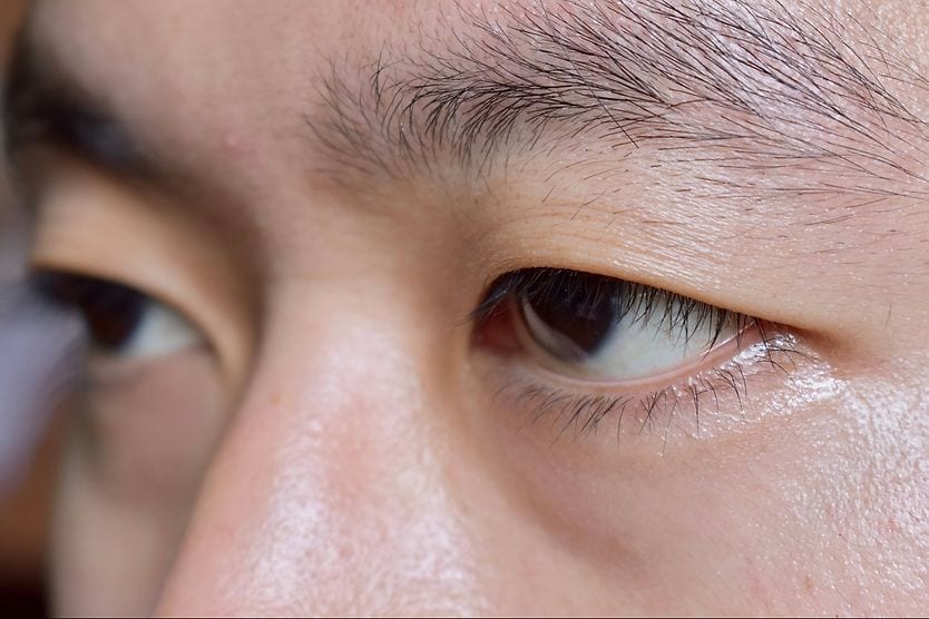 Monolids (vs. double eyelids) closeup of an Asian man with monolids