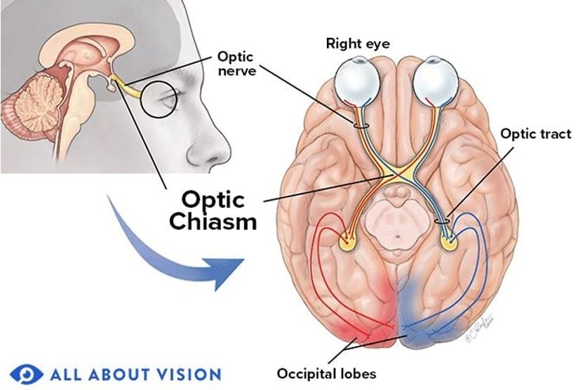 Optic Chiasm: Location, Function and Conditions medical illustration of the optic chiasm in the brain