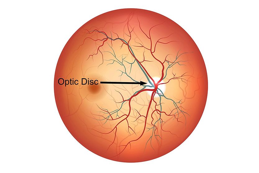 Optic Disc The optic disc is a round section at the back of the eye.