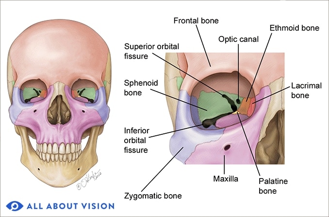What is an orbital bone, and what happens when an orbital bone breaks?