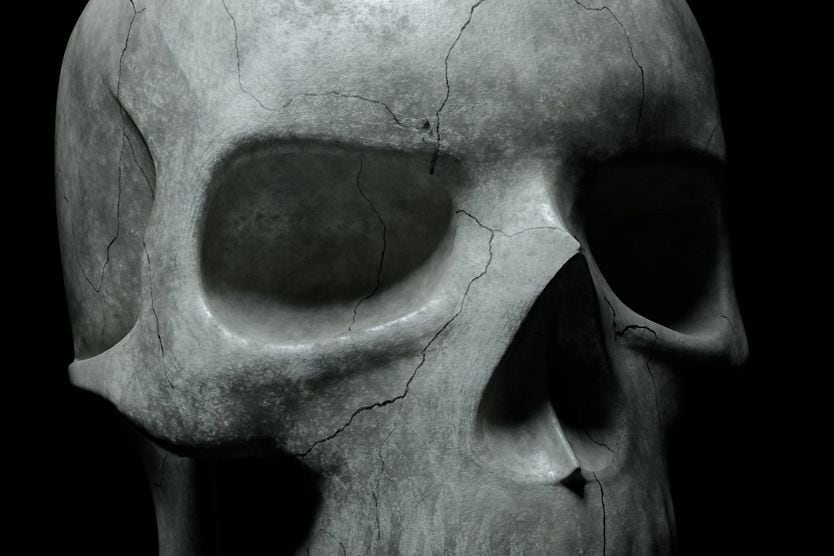 What is an orbital bone, and what happens when an orbital bone breaks? closeup of the orbital bone on a skeleton