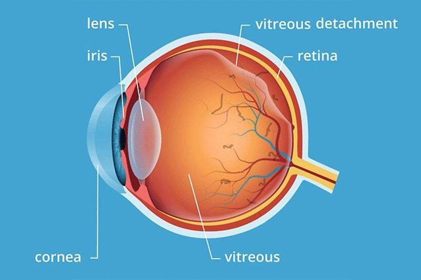 Vitreous humor: Gel of the eye eyeball illustration of vitreous humor