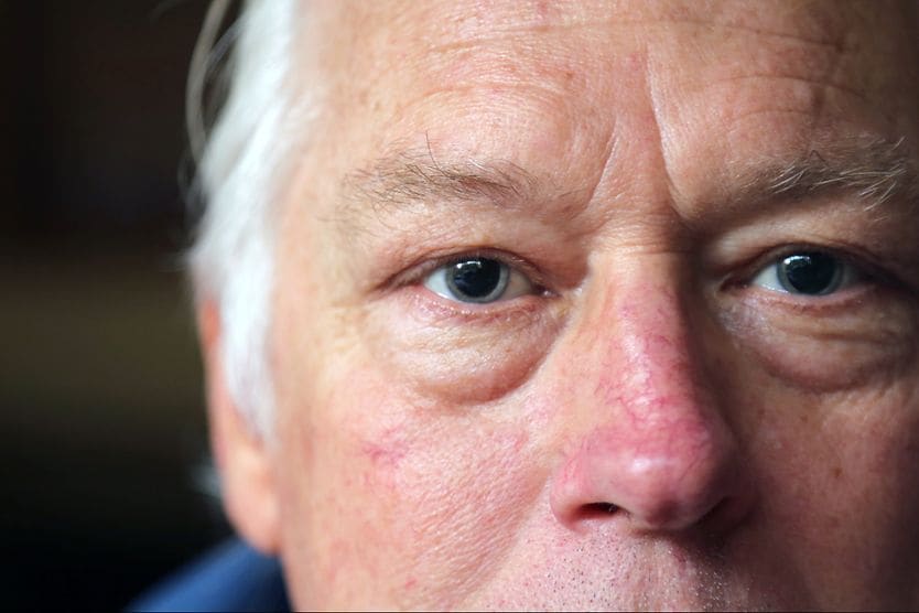 man with dilated eyes