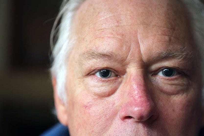 What happens after eye dilation? man with dilated eyes