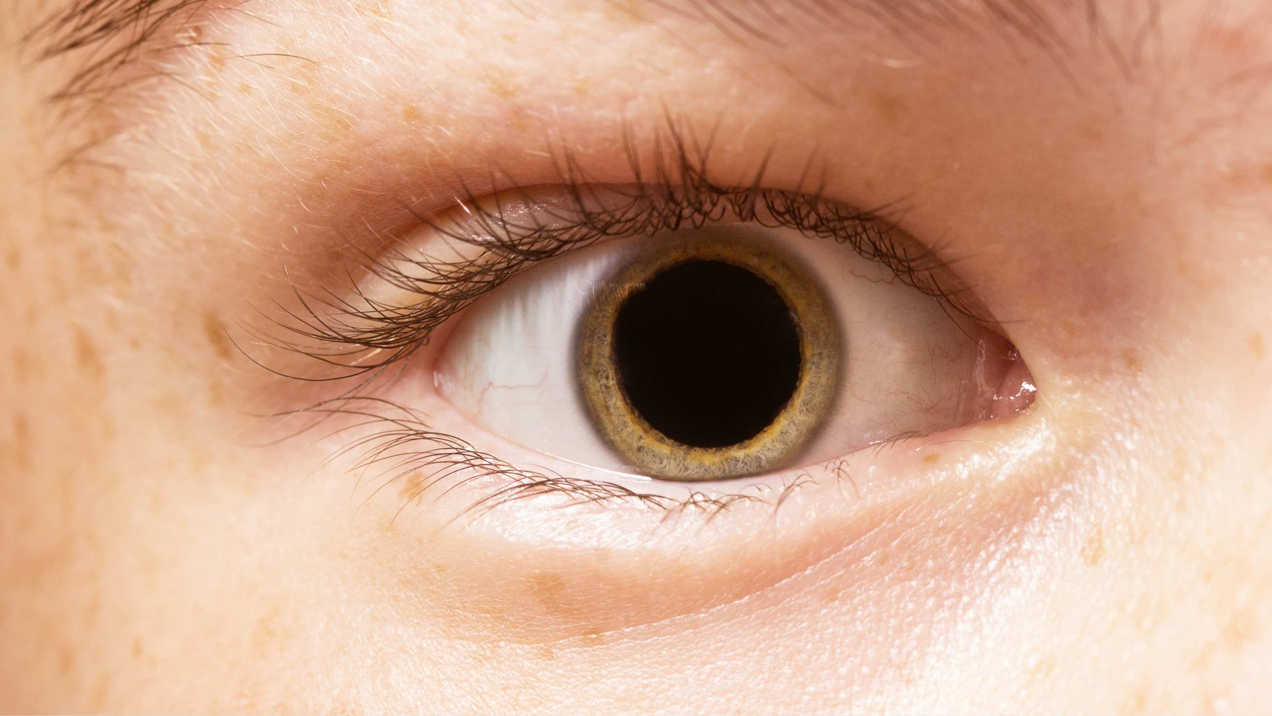 closeup of a dilated eye